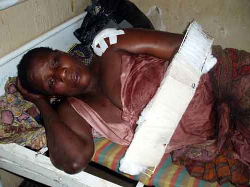 beni_nyaleke_femme_blessee.jpg